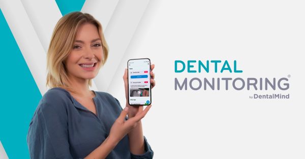 Dental monitoring